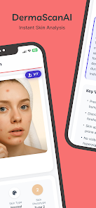 DermaScan AI