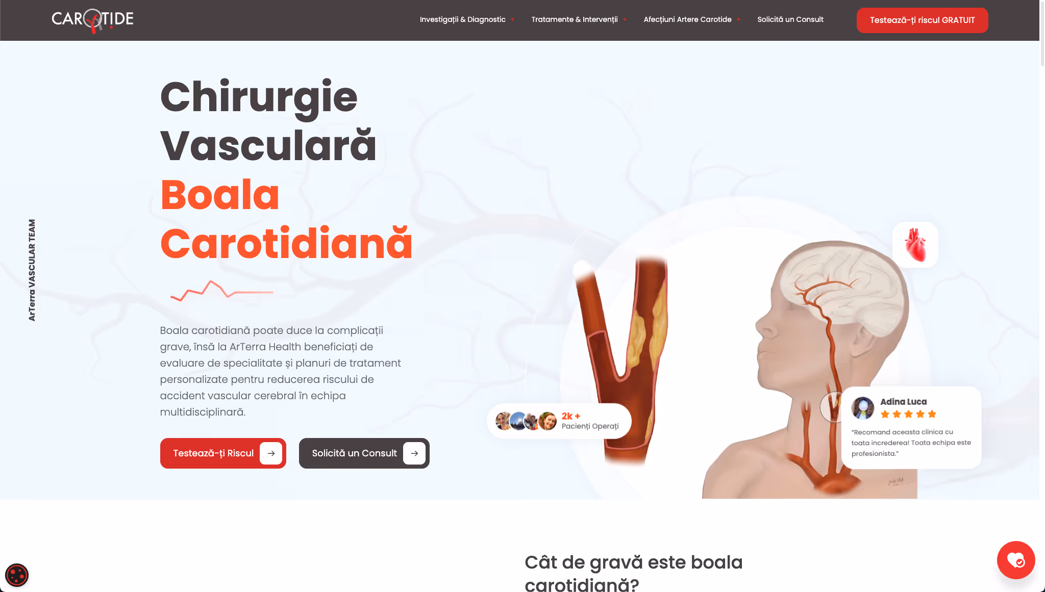 ArTerra Health - Carotide.ro