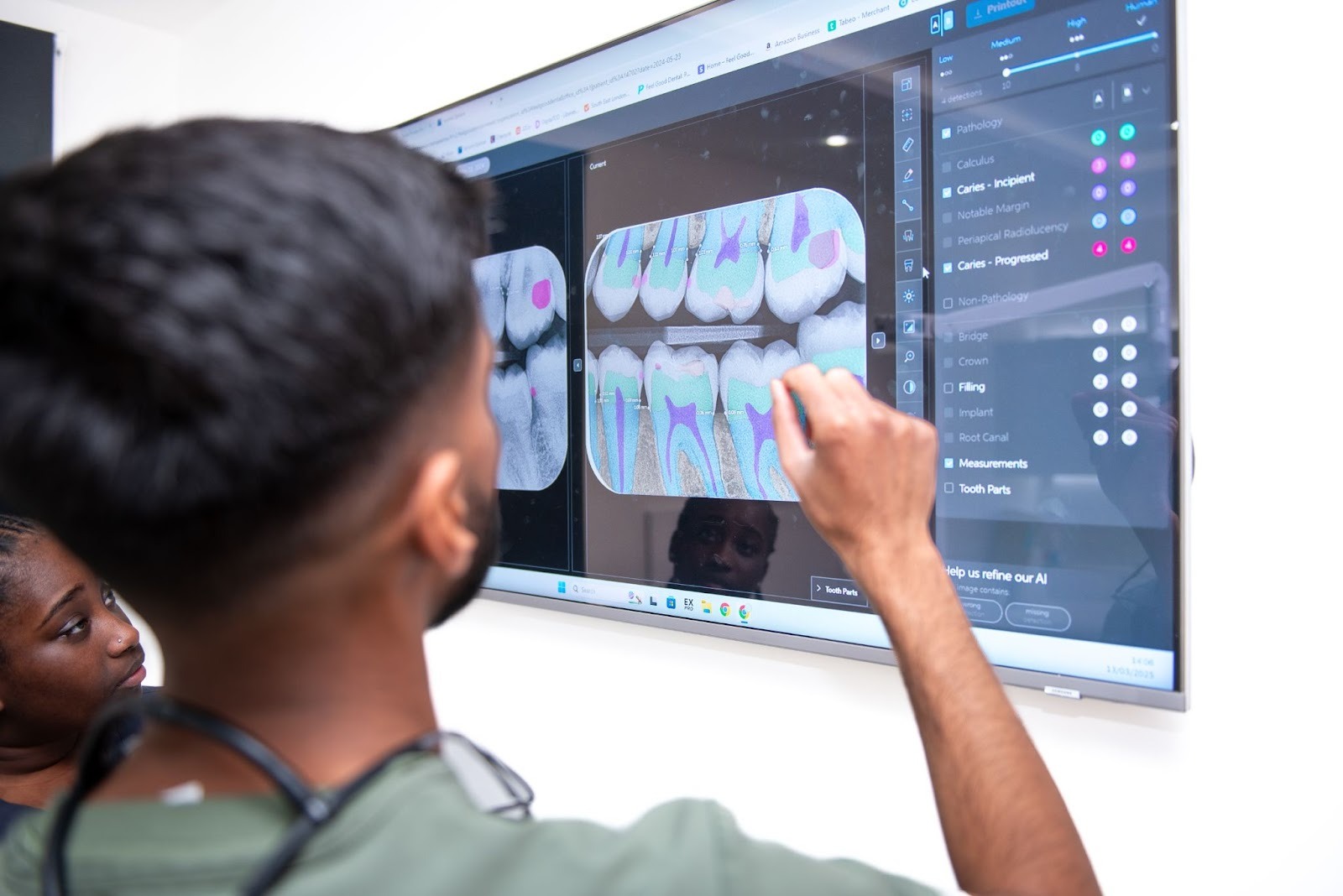 Dentist reviewing digital dental X-ray to assess tooth for crown treatment