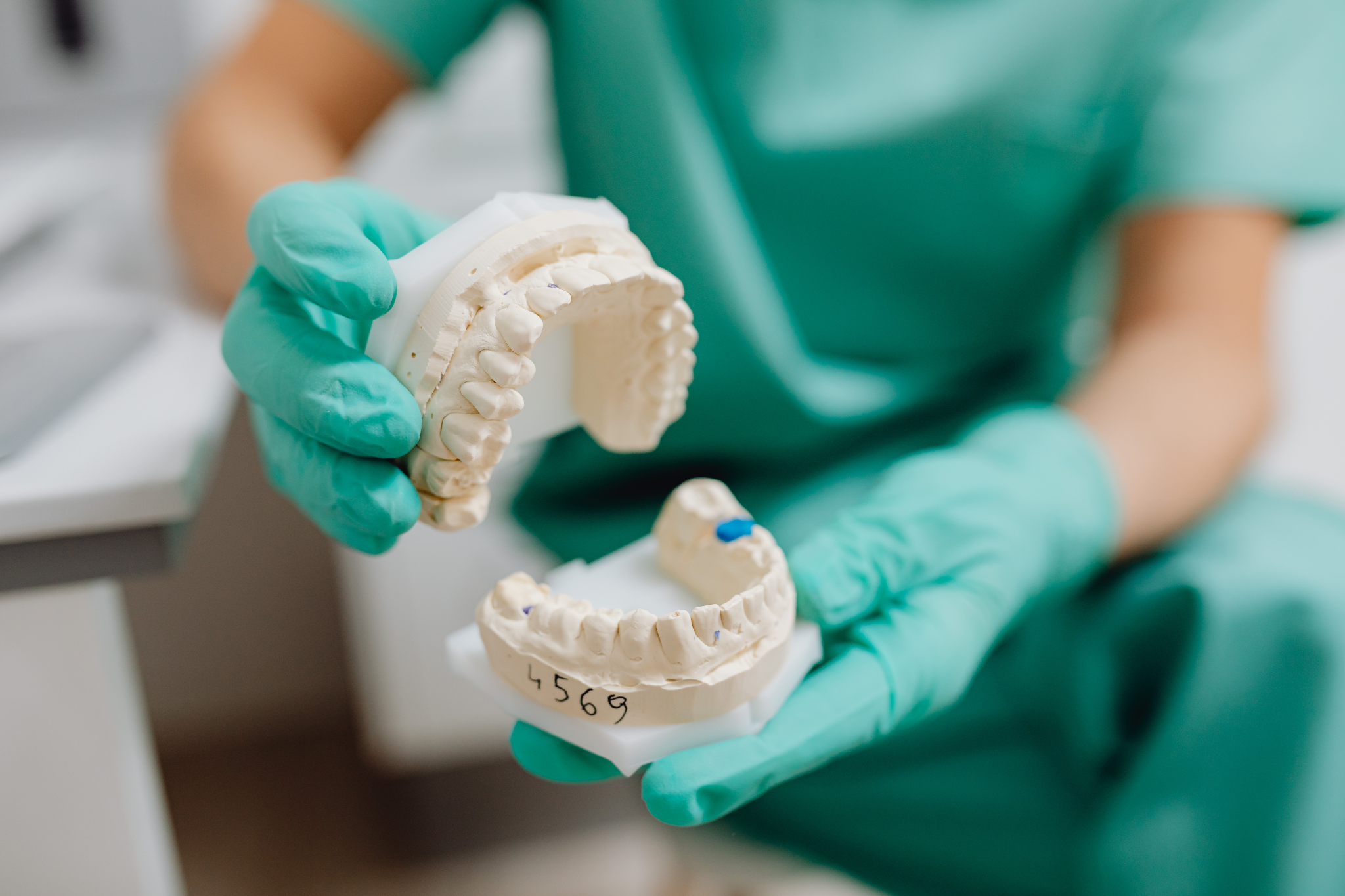 Dental model used to assess cavities and plan fillings at Croydon dentist