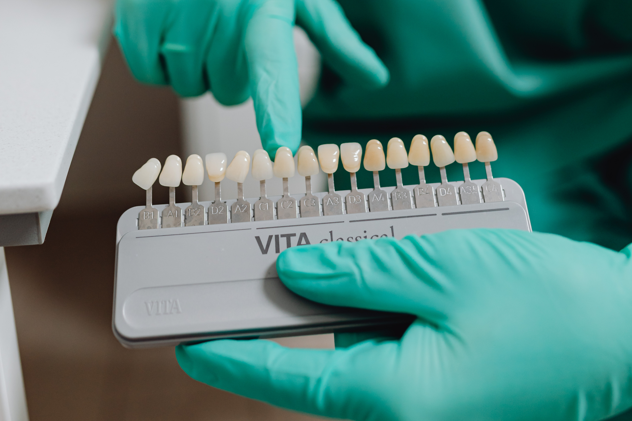 Dentist selecting porcelain veneer shade during cosmetic dentistry treatment planning in Croydon