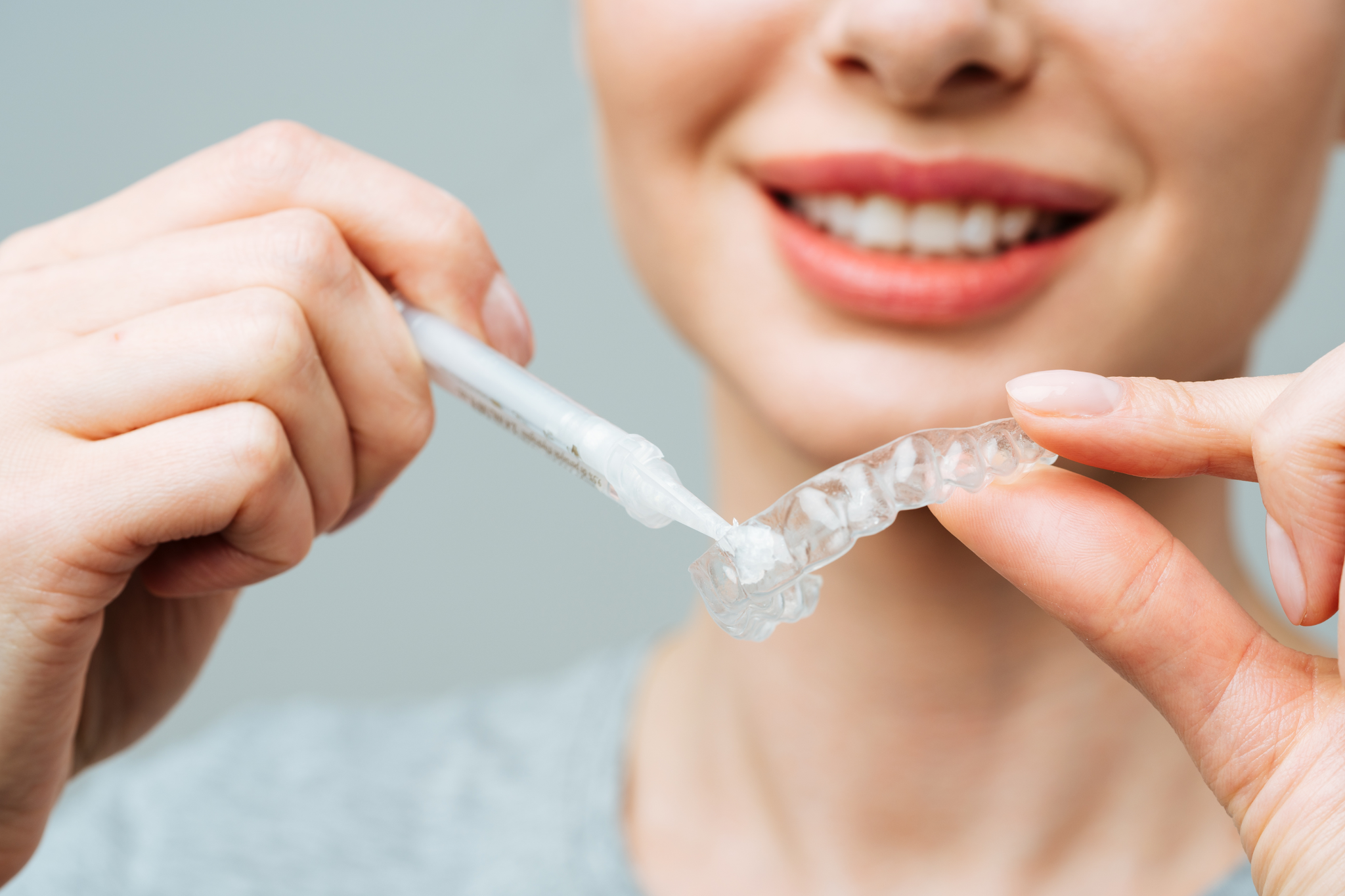 Professional teeth whitening tray with whitening gel for dentist-led home whitening treatment