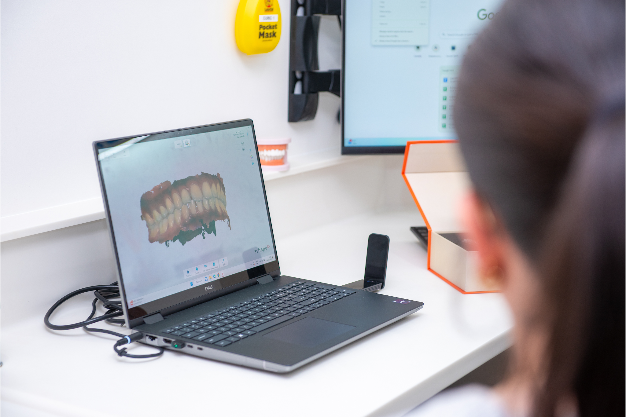Digital Invisalign treatment planning scan showing teeth alignment at Croydon dental practice