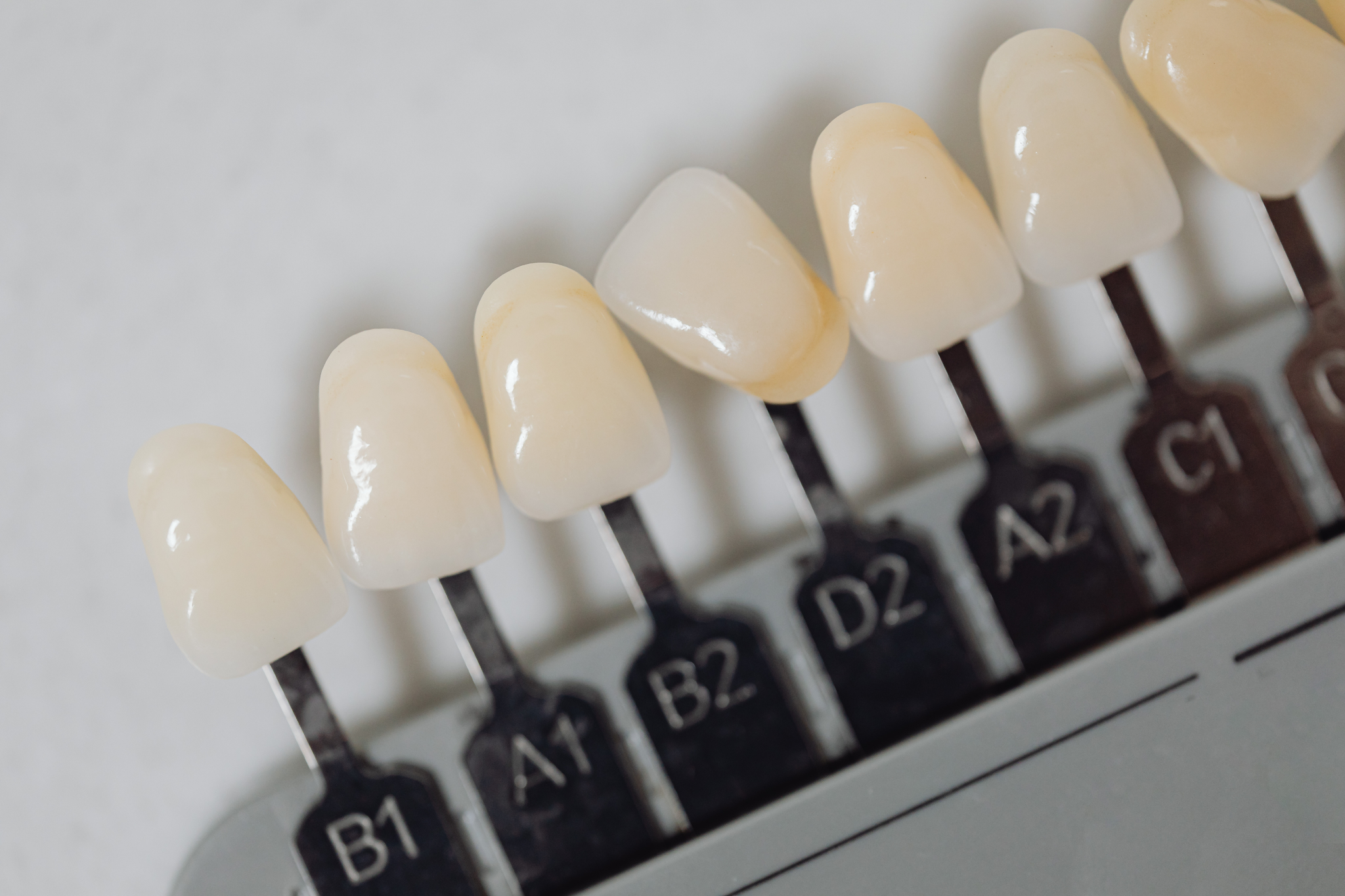 Porcelain veneer shade guide used to match veneers to natural teeth at Croydon dental practice