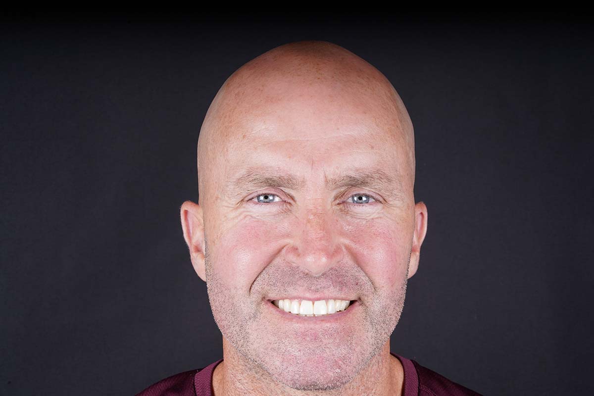 Male patient smiling after composite bonding treatment at Foxley Lane Dental in Purley. Close-up image shows even, natural-looking teeth and a confident smile following cosmetic dental work.