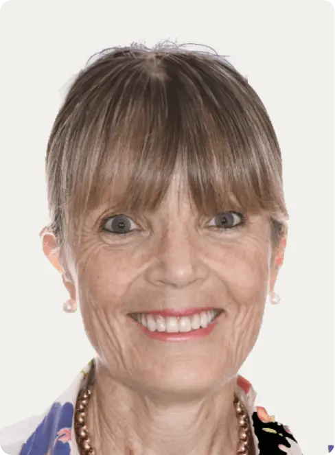 Macquarie Street Dental's patient photo after all-on-4 dental implants treatment.