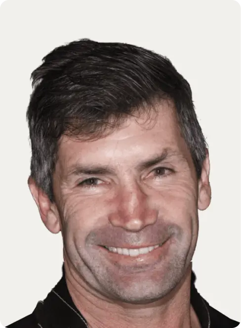 Macquarie Street Dental's patient photo after all-on-4 dental implants treatment.