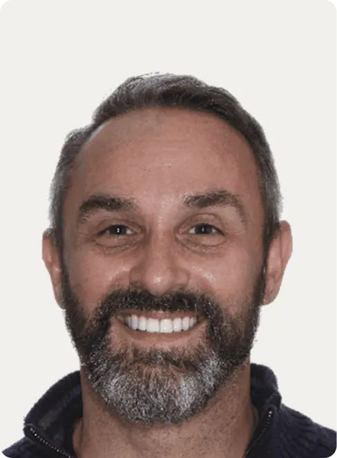 Image of a patient after Dental Crowns at Macquarie Street Dental.