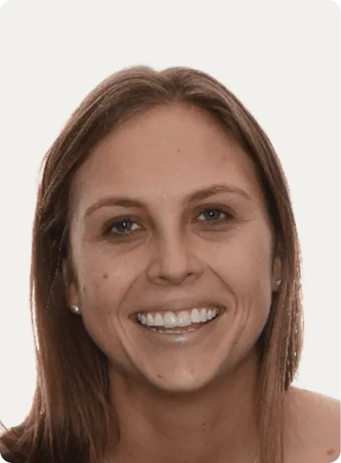 Photo of a patient before having a Smile makeover at Macquarie Street Dental.