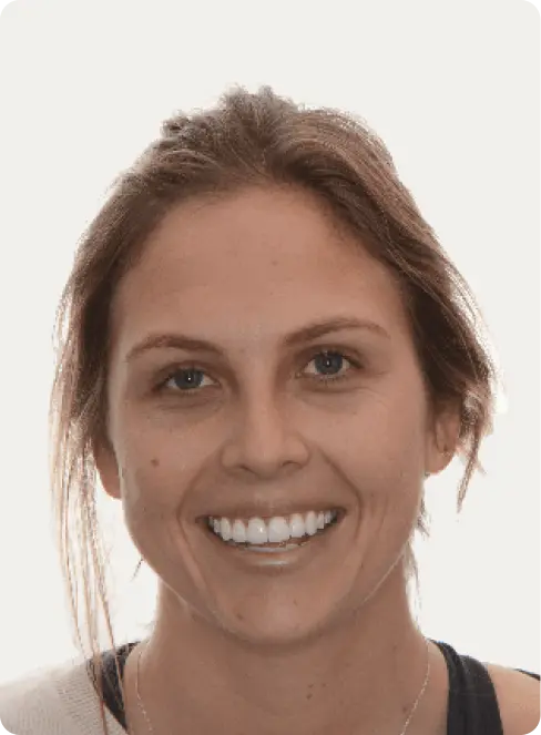 Photo of a patient after having a Smile makeover at Macquarie Street Dental.