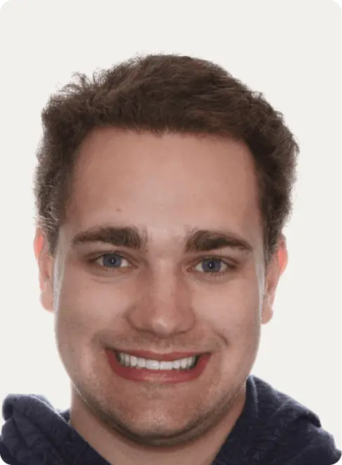 Image of a patient after Dental Implants at Macquarie Street Dental.