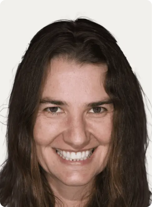Image of a patient after Invisalign treatment at Macquarie Street Dental.