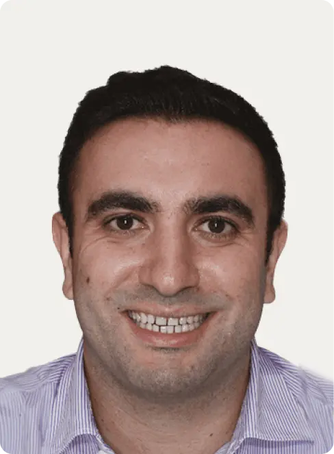 Image of a patient before Porcelain Veneers at Macquarie Street Dental.