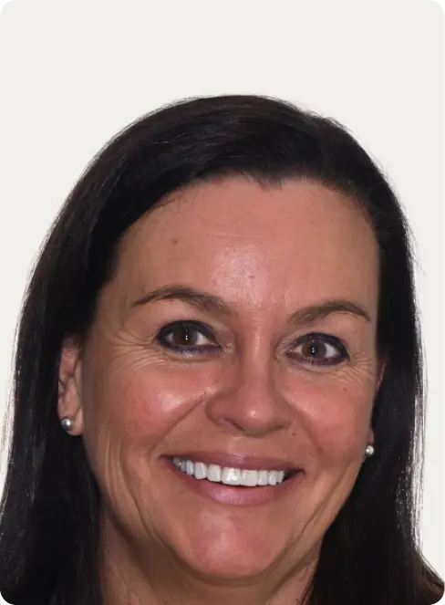 Photo of a patient after having a Smile makeover at Macquarie Street Dental.