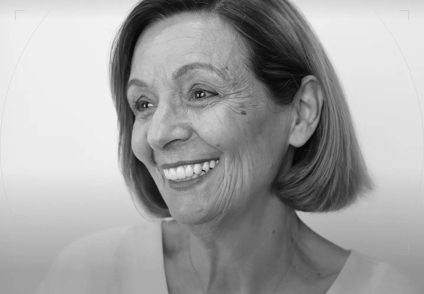 All on 4 Dental Implants