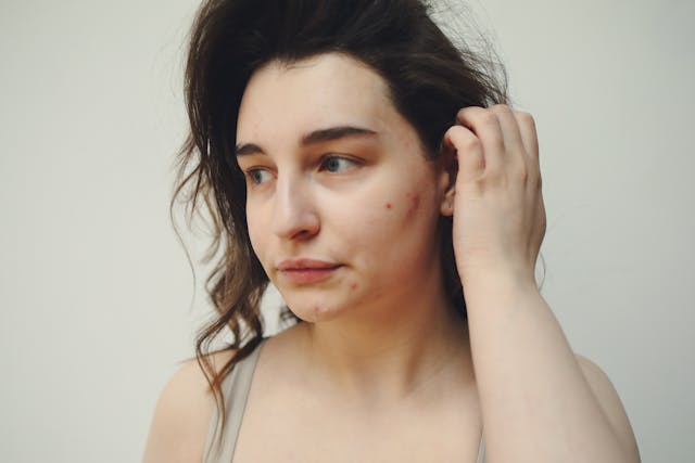 Autism and Puberty
