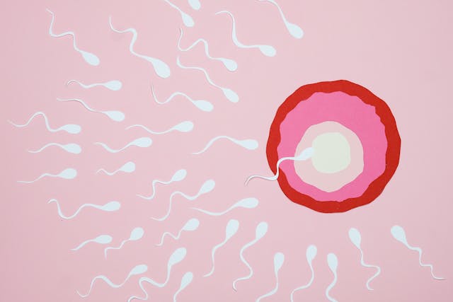 Autism and Old Sperm