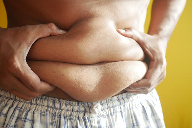 Obesity in Children with Autism Spectrum Disorders