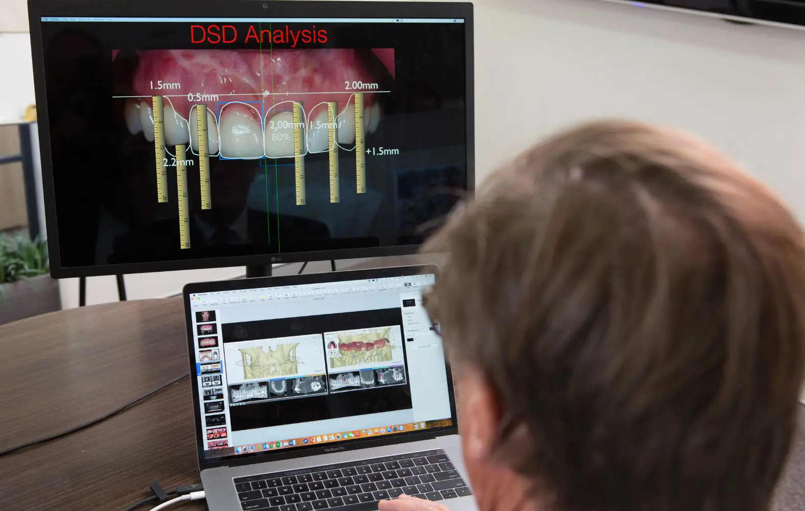 Dr David Dunn carefully plans the dental implants procedure for a patient before surgery at Macquarie Street Dental.