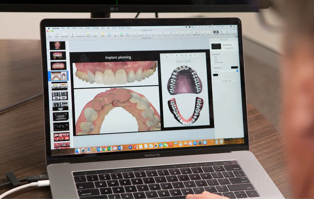 Dr David Dunn using a Digital Smile Design software to plan a patient’s dental implant placement at Macquarie Street Dental.