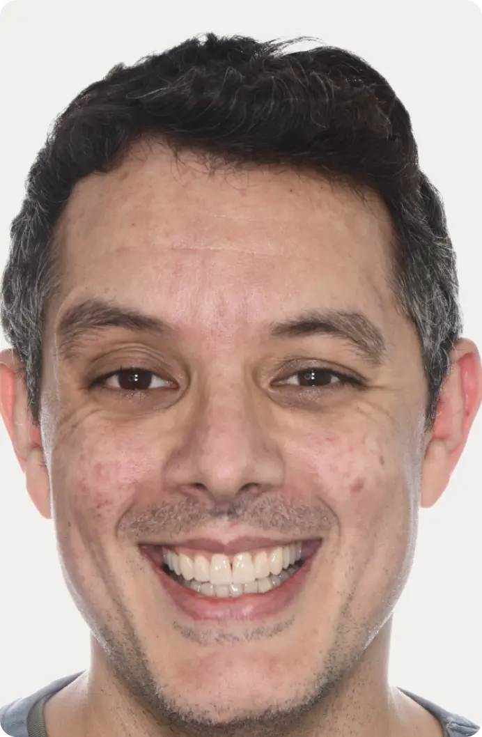 Image of a patient after having a Smile Makeover at Macquarie Street Dental.