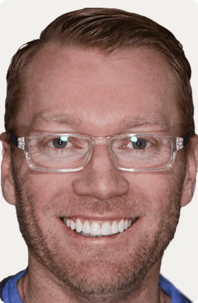 Image of a patient after porcelain veneers at Macquarie Street Dental.