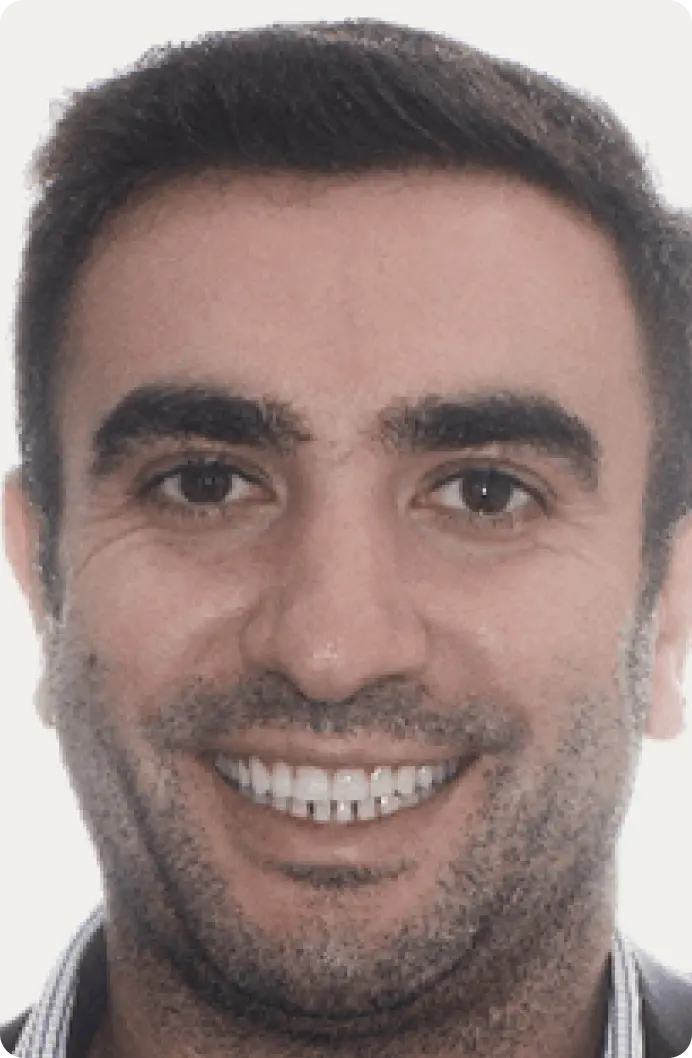 Image of a patient after porcelain veneers at Macquarie Street Dental.