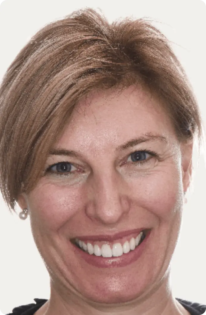 Image of a patient after dental implants at Macquarie Street Dental.