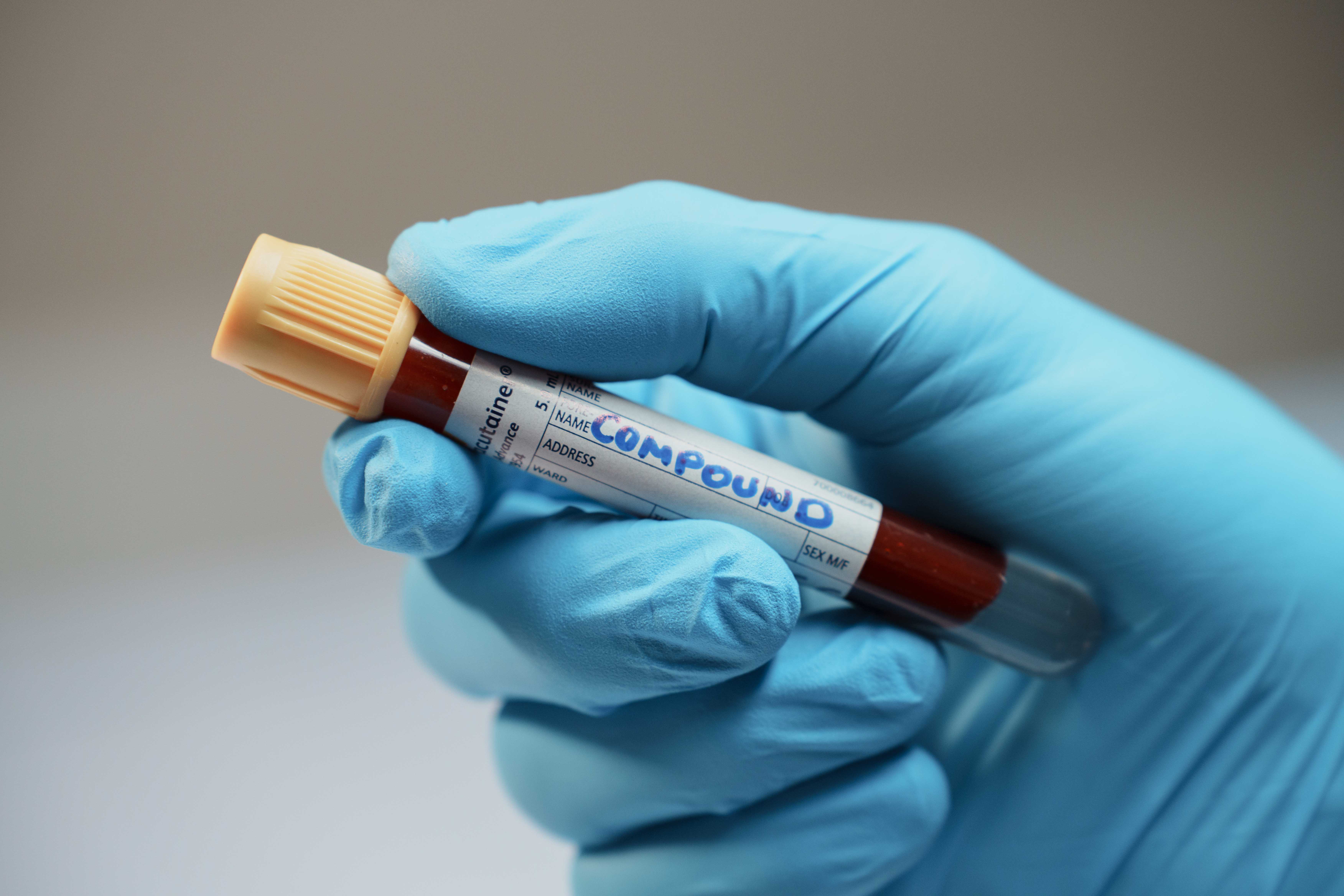 HbA1c blood test with Compound