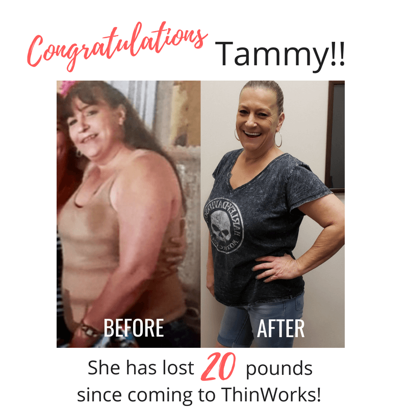 Tammy's amazing weight loss before and after photo.