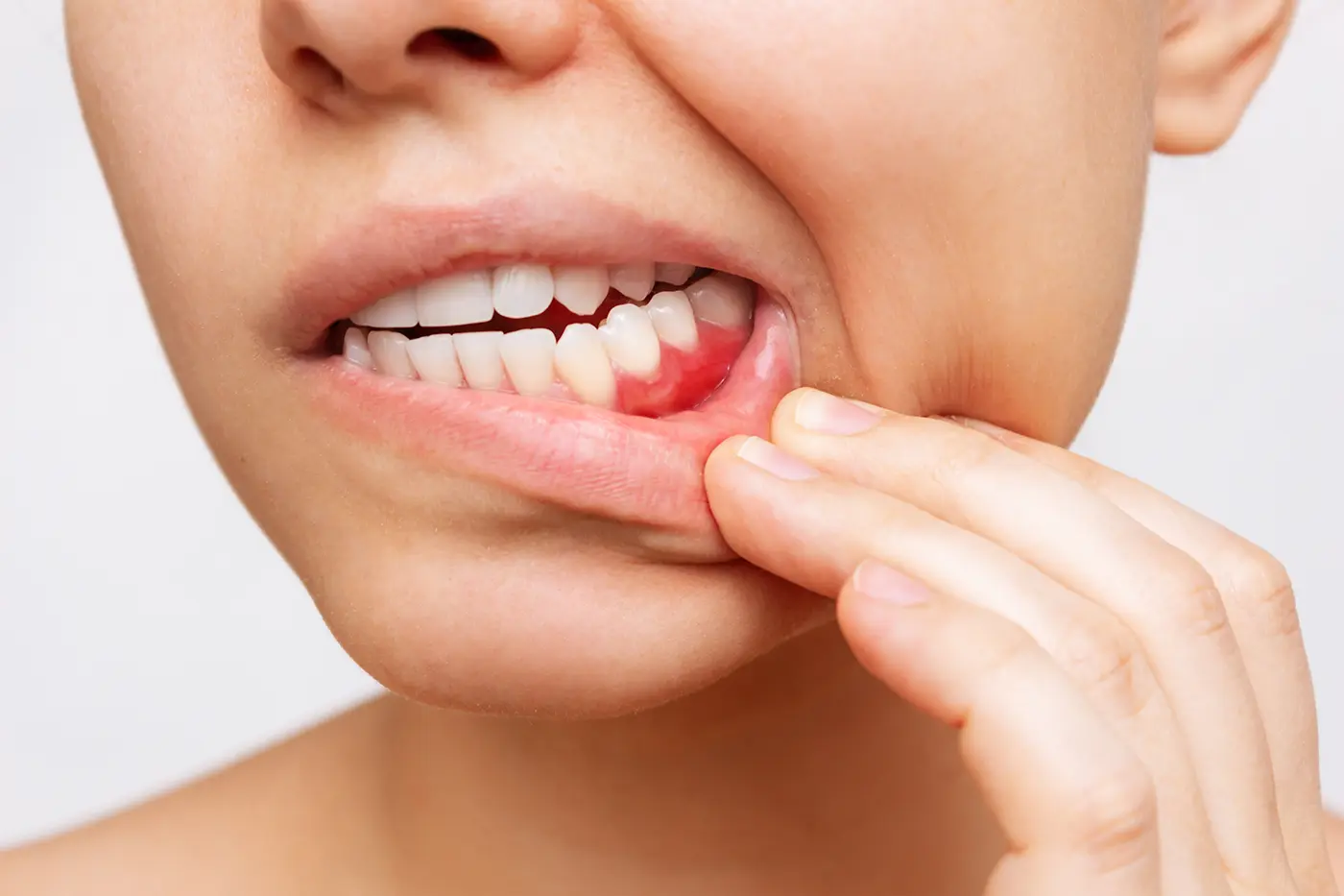 Gum Disease Treatment in Celebration, FL – Lumos Dental Studio