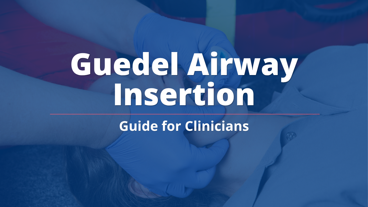 Guedel Airway Insertion Guide for Clinicians