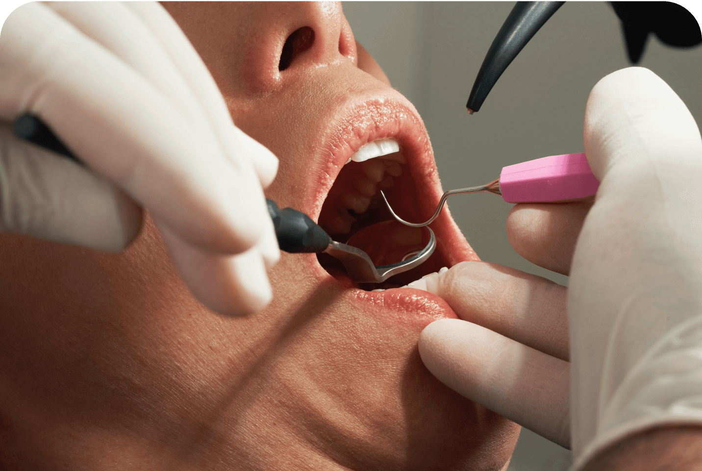 Top 5 tips for maintaining healthy teeth and gums
