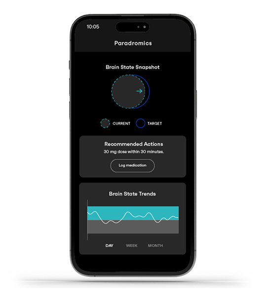 Render of neural data being processed through the Connexus Brain-Computer Interface Cortical Module to the Internal Transceiver along the lead
