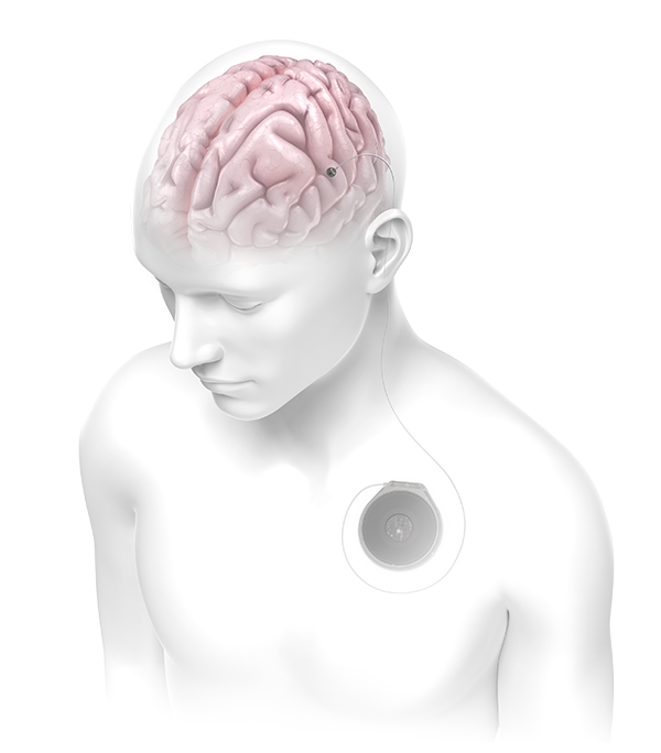 A female Paradromics team member looking into a microscope to inspect the Paradromics Brain-Computer Interface