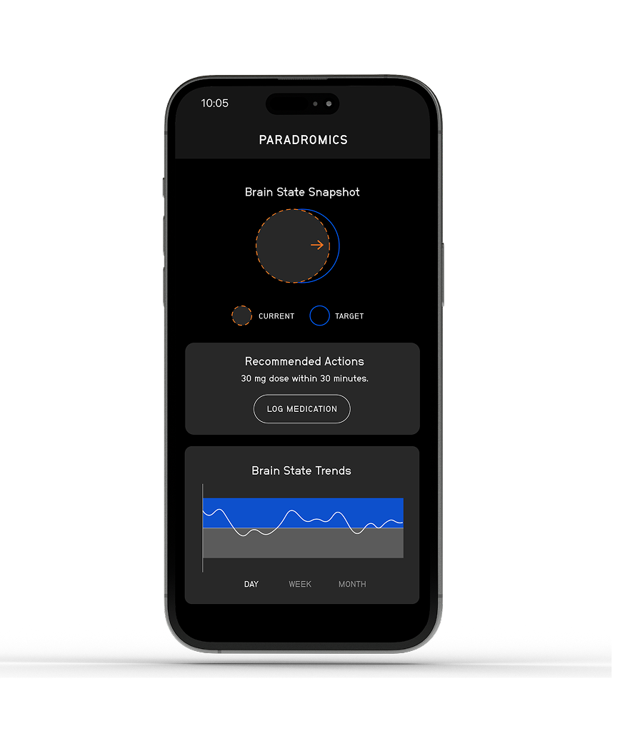 Render of neural data being processed through the Connexus Brain-Computer Interface Cortical Module to the Internal Transceiver along the lead