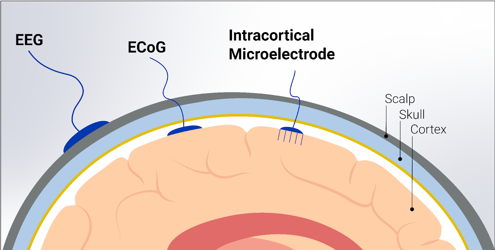 BCI Technologies Used in Assistive Communication