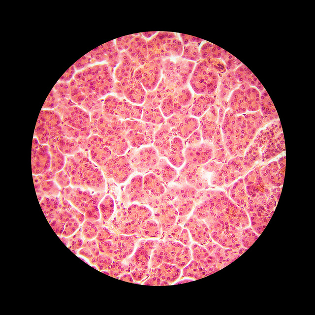 Moleculin Biotech Inc (NASDAQ:MBRX) Is On A Hot Streak, Can It Continue?