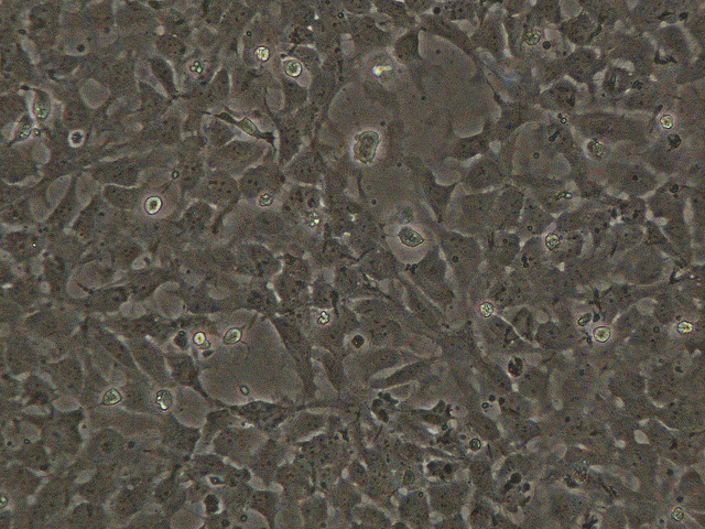 Markets Have Overlooked The Importance Of The Latest US Stem Cell Inc (OTCMKTS:USRM) Data