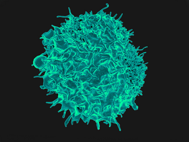 Here's What The Latest Latin America Deal Means For Immune Pharmaceuticals Inc (NASDAQ:IMNP)
