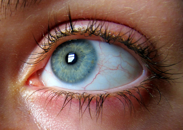 Here's The Bottom Line For Ocular Therapeutix, Inc. (NASDAQ:OCUL) Shareholders