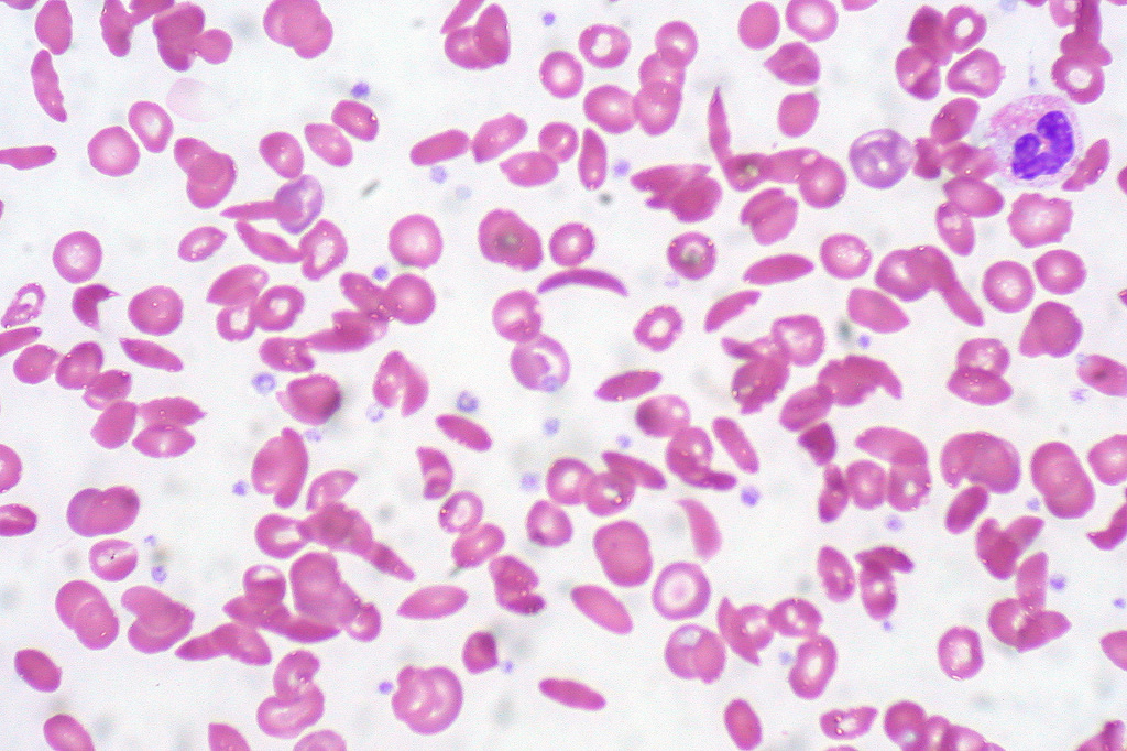 Generex Biotechnology Corporation (OTCMKTS:GNBT) On The Comeback Trail