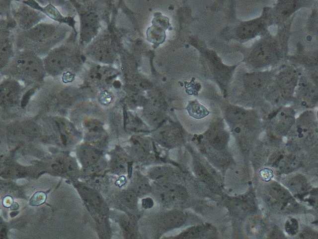 US Stem Cell Inc (OTCMKTS:USRM) Is Undervalued At Current Prices