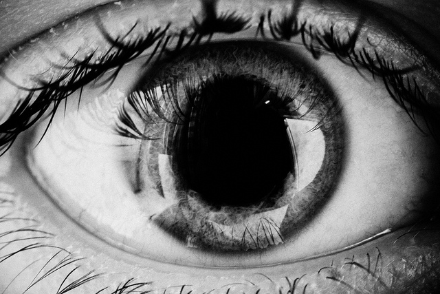 Here's Why Otonomy Inc (NASDAQ:OTIC) Is A Great Recovery Play