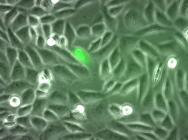 PhaseRx Inc (NASDAQ:PZRX) Is A Hidden Biotech Gem