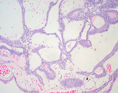 Endocyte, Inc. (NASDAQ:ECYT) Is Running: Here's Why And What's Next