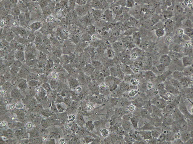 US Stem Cell Inc (OTCMKTS:USRM) Could Be A Nice Recovery Play