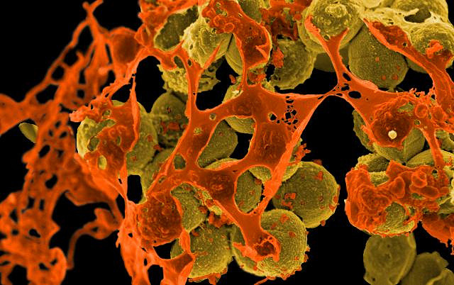 BioLife Solutions Inc (NASDAQ:BLFS) Is A Real Winner In Regenerative Medicine