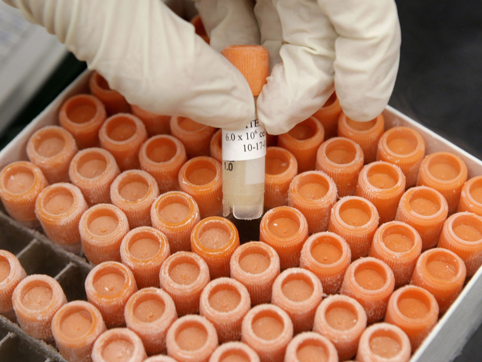 US Stem Cell Inc (OTCMKTS:USRM) Still A Nice Recovery Play As Stem Cell Demand Explodes