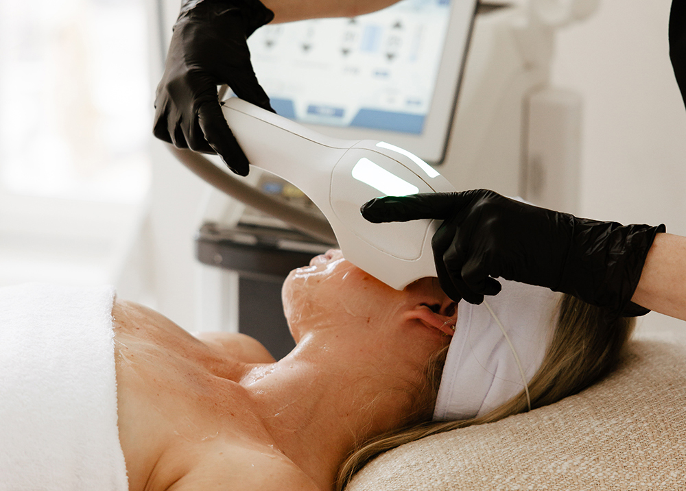 Kobieta otrzymująca zabieg laserowy na twarz z użyciem białego urządzenia kosmetycznego przez osobę w czarnych rękawiczkach. BBL HEROIC SCITON